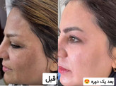 صابون زیبایی بیوممتیک چندکاره--شفاف کننده-ضد خشکی-رفع جوش چرکی- لایه بردار-پک 3 عددی برند استین دکتربیز